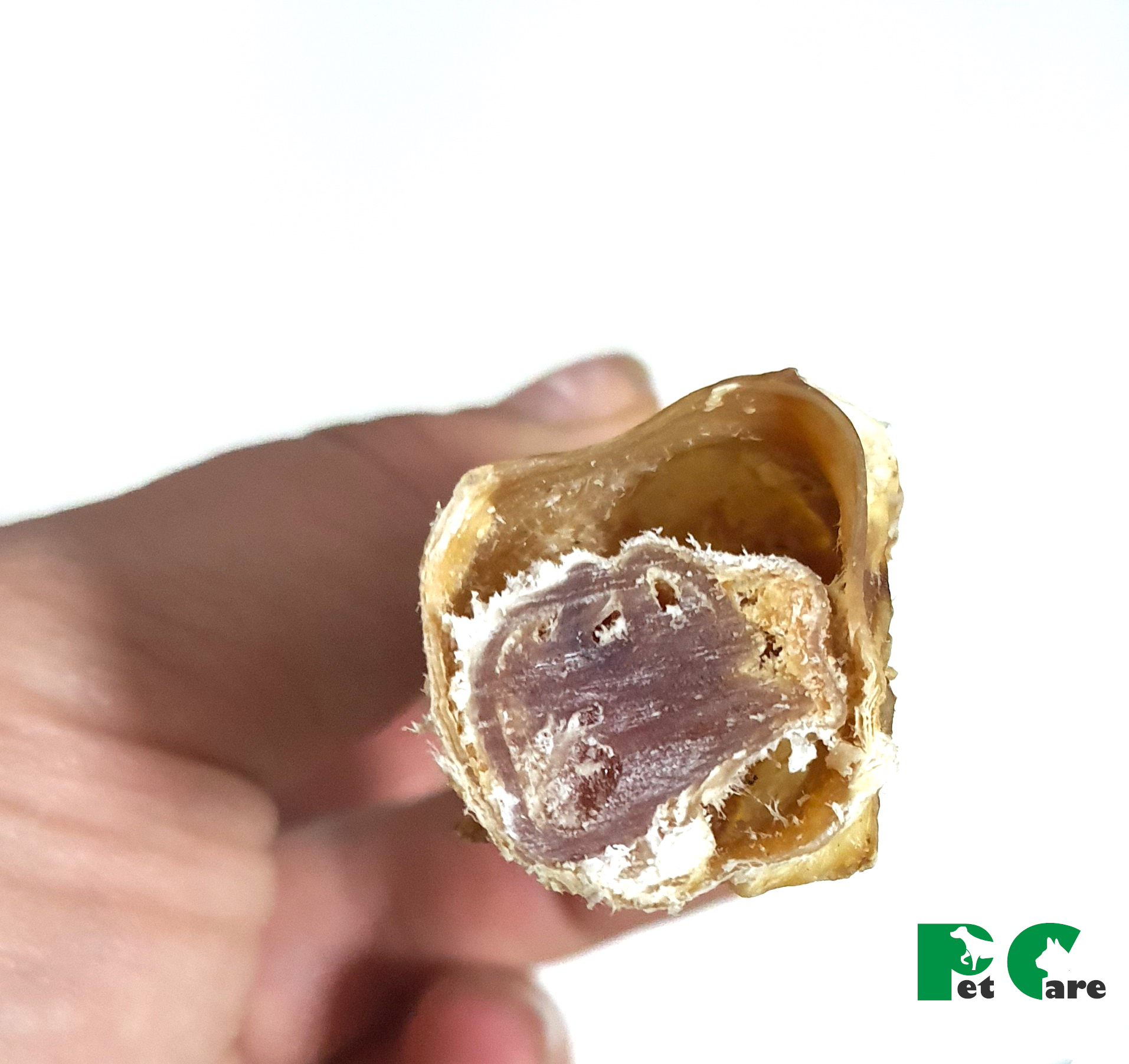 Бычий корень в аорте